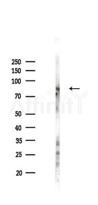 Phospho-beta Catenin (Tyr333) Antibody - Western blot analysis of lysates from Hela cells(LPS,4h treatment), using Phospho-beta Catenin (Tyr333) Antibody at 1/1000 dilution.