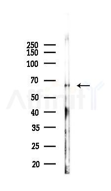 Phospho-YY1 (Ser365) Antibody - Western blot analysis of lysates from B16F10-LUC cells(uv30min treatment), using Phospho-YY1 (Ser365) Antibody at 1/1000 dilution.