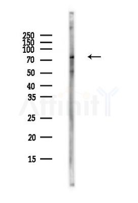 Phospho-GRK2 (Ser670) Antibody - Western blot analysis of lysates from MCF7 cells(heat-shock,45min treatment), using Phospho-GRK2 (Ser670) Antibody at 1/1000 dilution.