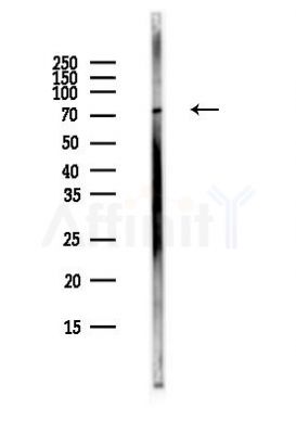 Phospho-GRK2 (Ser670) Antibody - Western blot analysis of lysates from COLO205 cells(heat-shock,45min treatment), using Phospho-GRK2 (Ser670) Antibody at 1/1000 dilution.
