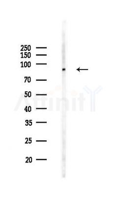 Phospho-A20/TNFAIP3 (Ser381) Antibody - Western blot analysis of lysates from K562 cells(UV,30min treatment), using Phospho-A20/TNFAIP3 (Ser381) Antibody at 1/1000 dilution.