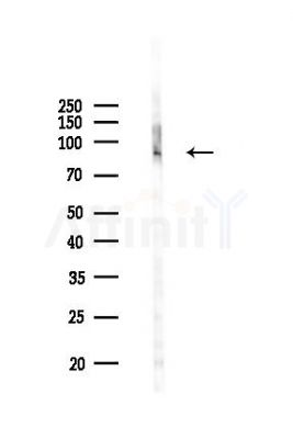Phospho-A20/TNFAIP3 (Ser381) Antibody - Western blot analysis of lysates from B16F10-LUC cells(UV,30min treatment), using Phospho-A20/TNFAIP3 (Ser381) Antibody at 1/1000 dilution.