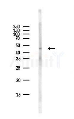 Phospho-PKA R2 (Ser99) Antibody - Western blot analysis of lysates from Rat liver, using Phospho-PKA R2 (Ser99) Antibody at 1/1000 dilution.