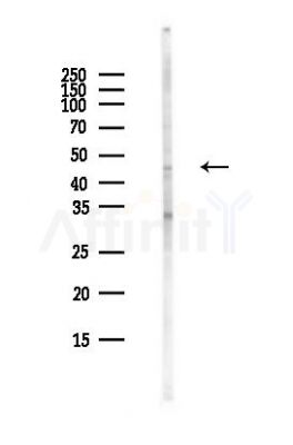 Phospho-PKA R2 (Ser99) Antibody - Western blot analysis of lysates from MCF7 cells(heat-shock,45min treatment), using Phospho-PKA R2 (Ser99) Antibody at 1/1000 dilution.