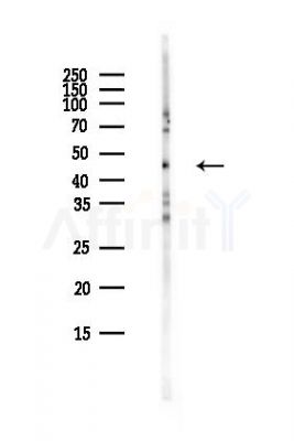Phospho-PKA R2 (Ser99) Antibody - Western blot analysis of lysates from COLO205 cells(heat-shock,45min treatment), using Phospho-PKA R2 (Ser99) Antibody at 1/1000 dilution.