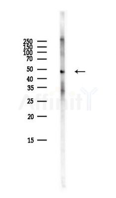 Phospho-PKA R2 (Ser99) Antibody - Western blot analysis of lysates from Mouse brain, using Phospho-PKA R2 (Ser99) Antibody at 1/1000 dilution.