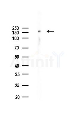 Phospho-EPRS (Ser886) Antibody - Western blot analysis of lysates from K562 cells(UV,30min treatment), using Phospho-EPRS (Ser886) Antibody at 1/1000 dilution.