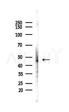 Acetyl-P53 (Lys382) Antibody - Western blot analysis of lysates from HepG2 cells(starvation,24h treatment), using Acetyl-P53 (Lys382) Antibody at 1/1000 dilution.