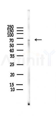 Phospho-Lamin A/C (Ser22) Antibody - Western blot analysis of lysates from HUVEC cells(LPS,4h treatment), using Phospho-Lamin A/C (Ser22) Antibody at 1/1000 dilution.