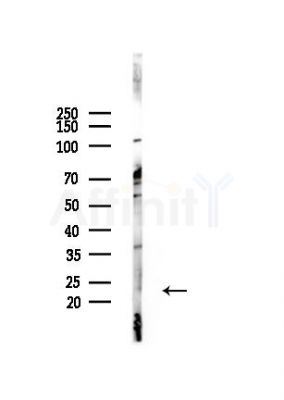 Phospho-RAB7L1 (Thr71) Antibody - Western blot analysis of lysates from Hela cells(heat-shock,45min treatment), using Phospho-RAB7L1 (Thr71) Antibody at 1/1000 dilution.