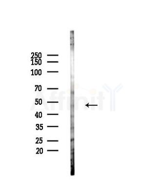 Phospho-SGK2 (Thr253) Antibody - Western blot analysis of lysates from Hela cells(heat-shock,45min treatment), using Phospho-SGK2 (Thr253) Antibody at 1/1000 dilution.