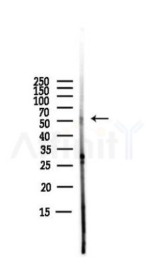 Phospho-CaMKII alpha (Ser331) Antibody - Western blot analysis of lysates from PC12 cells(LPS,4h treatment), using Phospho-CaMKII alpha (Ser331) Antibody at 1/1000 dilution.