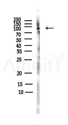 Phospho-RSK1 p90 (Ser380) Antibody - Western blot analysis of lysates from Rat brain, using Phospho-RSK1 p90 (Ser380) Antibody at 1/1000 dilution.