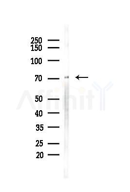 Phospho-ICK (Tyr159) Antibody - Western blot analysis of lysates from HepG2 cells(starvation,24h treatment), using Phospho-ICK (Tyr159) Antibody at 1/1000 dilution.