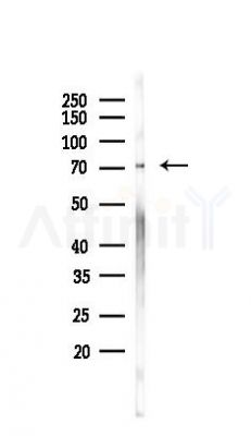 Phospho-ICK (Tyr159) Antibody - Western blot analysis of lysates from 293 cells, using Phospho-ICK (Tyr159) Antibody at 1/1000 dilution.