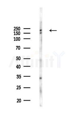 Phospho-53BP1 (Ser25/Ser29) Antibody - Western blot analysis of lysates from B16F10-LUC cells(UV,30min treatment), using Phospho-53BP1 (Ser25/Ser29) Antibody at 1/1000 dilution.