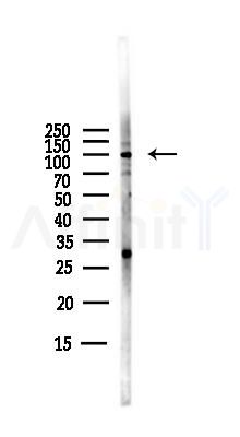 Phospho-EZH2 (Ser21) Antibody - Western blot analysis of lysates from PC12 cells(LPS,4h treatment), using Phospho-EZH2 (Ser21) Antibody at 1/1000 dilution.