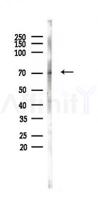 Phospho-CDC25A (Ser76) Antibody - Western blot analysis of lysates from EC304 cells, using Phospho-CDC25A (Ser76) Antibody at 1/1000 dilution.