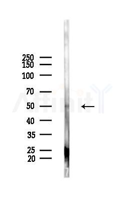 Phospho-Perilipin-1 (Ser522) Antibody - Western blot analysis of lysates from EC304 cells(heat-shock,45min treatment), using Phospho-Perilipin-1 (Ser522) Antibody at 1/1000 dilution.