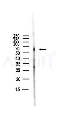Phospho-Paxillin (Ser178) Antibody - Western blot analysis of lysates from PC12 cells(LPS,4h treatment), using Phospho-Paxillin (Ser178) Antibody at 1/1000 dilution.