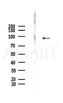 Phospho-FGFR2 (Tyr586/Tyr588) Antibody - Western blot analysis of lysates from EC304 cells(heat-shock,45min treatment), using Phospho-FGFR2 (Tyr586/Tyr588) Antibody at 1/1000 dilution.