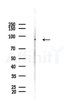 Phospho-FGFR2 (Tyr586/Tyr588) Antibody - Western blot analysis of lysates from HepG2 cells(heat-shock,45min treatment), using Phospho-FGFR2 (Tyr586/Tyr588) Antibody at 1/1000 dilution.