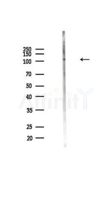 Phospho-PKD1/PKC mu (Ser910) Antibody - Western blot analysis of lysates from MCF7 cells, using Phospho-PKD1/PKC mu (Ser910) Antibody at 1/1000 dilution.