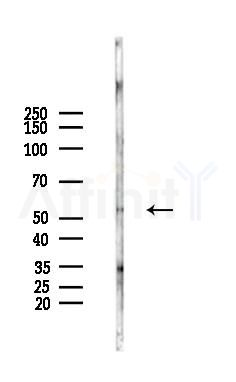 Phospho-TFEB (Ser142) Antibody - Western blot analysis of lysates from EC304 cells(heat-shock,45min treatment), using Phospho-TFEB (Ser142) Antibody at 1/1000 dilution.