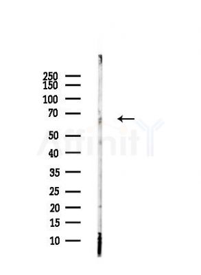 Phospho-TGFBR2 (Ser553) Antibody - Western blot analysis of lysates from Hela cells(heat-shock,45min treatment), using Phospho-TGFBR2 (Ser553) Antibody at 1/1000 dilution.
