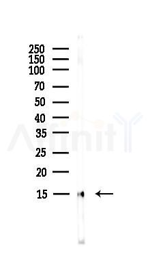 Phospho-Histone H3 (Ser28) Antibody - Western blot analysis of lysates from EC304 cells(heat-shock,45min treatment), using Phospho-Histone H3 (Ser28) Antibody at 1/1000 dilution.