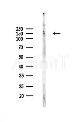 Phospho-ZO-2 (Tyr1118) Antibody - Western blot analysis of lysates from Rat brain, using Phospho-ZO-2 (Tyr1118) Antibody at 1/1000 dilution.