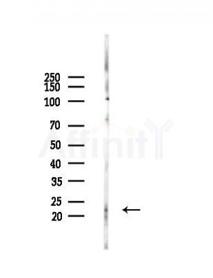 Phospho-BID (Ser78) Antibody - Western blot analysis of lysates from COLO205 cells(heat-shock,45min treatment), using Phospho-BID (Ser78) Antibody at 1/1000 dilution.
