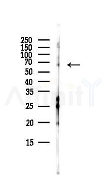 Phospho-n-Myc (Ser261/Ser263) Antibody - Western blot analysis of lysates from RAW264.