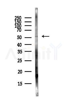 Phospho-MLKL (Ser345) Antibody - Western blot analysis of lysates from Rat lung, using Phospho-MLKL (Ser345) Antibody at 1/1000 dilution.