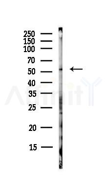 Phospho-MLKL (Ser345) Antibody - Western blot analysis of lysates from EC304 cells(heat-shock,45min treatment), using Phospho-MLKL (Ser345) Antibody at 1/1000 dilution.