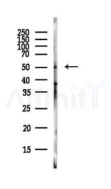 Phospho-Pim-1 (Tyr309) Antibody - Western blot analysis of lysates from Rat lung, using Phospho-Pim-1 (Tyr309) Antibody at 1/1000 dilution.