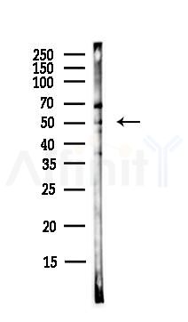 Phospho-Pim-1 (Tyr309) Antibody - Western blot analysis of lysates from EC304 cells(heat-shock,45min treatment), using Phospho-Pim-1 (Tyr309) Antibody at 1/1000 dilution.