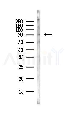 Phospho-C-RAF (Ser642) Antibody - Western blot analysis of lysates from Rat lung, using Phospho-C-RAF (Ser642) Antibody at 1/1000 dilution.