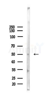 Phospho-WWOX (Tyr33) Antibody - Western blot analysis of lysates from HUVEC cells(heat-shock,45min treatment), using Phospho-WWOX (Tyr33) Antibody at 1/1000 dilution.