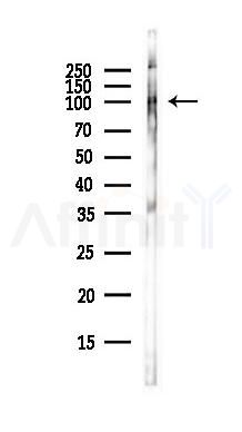 Phospho-EPB41 (Tyr660/Tyr418) Antibody - Western blot analysis of lysates from COLO205 cells(heat-shock,45min treatment), using Phospho-EPB41 (Tyr660/Tyr418) Antibody at 1/1000 dilution.