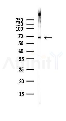 Phospho-PLK1 (Ser137) Antibody - Western blot analysis of lysates from COLO205 cells(heat-shock,45min treatment), using Phospho-PLK1 (Ser137) Antibody at 1/1000 dilution.
