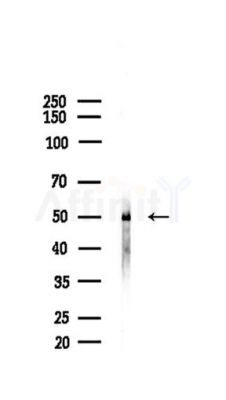 Phospho-Tau (Ser202/Ser519) Antibody - Western blot analysis of lysates from HUVEC cells(heat-shock,45min treatment), using Phospho-Tau (Ser202/Ser519) Antibody at 1/1000 dilution.