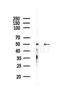 Phospho-Tau (Ser202/Ser519) Antibody - Western blot analysis of lysates from A375 cells, using Phospho-Tau (Ser202/Ser519) Antibody at 1/1000 dilution.