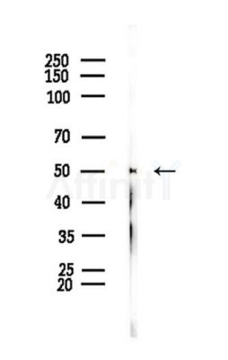 Phospho-Tau (Ser202/Ser519) Antibody - Western blot analysis of lysates from PC12 cells, using Phospho-Tau (Ser202/Ser519) Antibody at 1/1000 dilution.