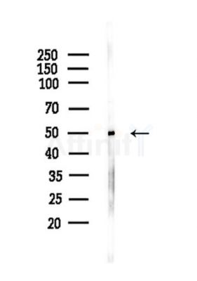 Phospho-Tau (Ser202/Ser519) Antibody - Western blot analysis of lysates from Mouse liver, using Phospho-Tau (Ser202/Ser519) Antibody at 1/1000 dilution.