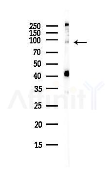 Phospho-Insulin Receptor (Thr1375) Antibody - Western blot analysis of lysates from COLO205 cells(heat-shock,45min treatment), using Phospho-Insulin Receptor (Thr1375) Antibody at 1/1000 dilution.