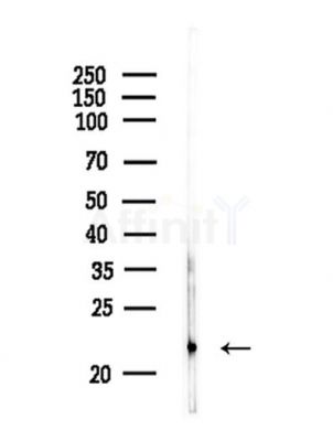 Phospho-HP1 alpha (Ser92) Antibody - Western blot analysis of lysates from A375 cells, using Phospho-HP1 alpha (Ser92) Antibody at 1/1000 dilution.