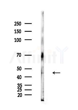 Phospho-p38 MAPK (Thr180/Tyr182) Antibody - Western blot analysis of lysates from Hela cells(heat-shock,45min treatment), using Phospho-p38 MAPK (Thr180/Tyr182) Antibody at 1/1000 dilution.