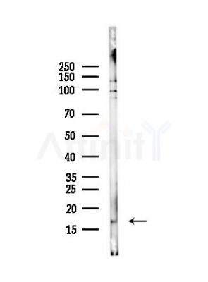 Cleaved-IL-1 beta (Asp116) Antibody - Western blot analysis of lysates from HUVEC cells(UV,30min treatment), using Cleaved-IL-1 beta (Asp116) Antibody at 1/1000 dilution.