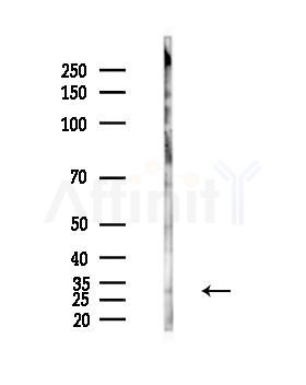 Cleaved-DFNA5/GSDME Antibody - N-terminal - Western blot analysis of lysates from PC12 cells(LPS,4h treatment), using DFNA5/GSDME Antibody - N-terminal at 1/1000 dilution.